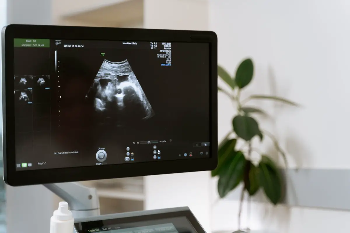 A monitor with ultrasound imaging. Source: pexels